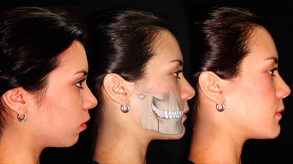 Cirugía Maxilofacial y Ortodoncia Quirúrgica